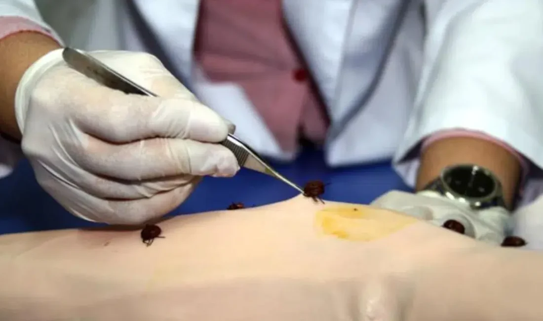 Yozgat’ın Sorgun ilçesinde kene tutunması sonrası hastaneye kaldırılan ve günlerdir