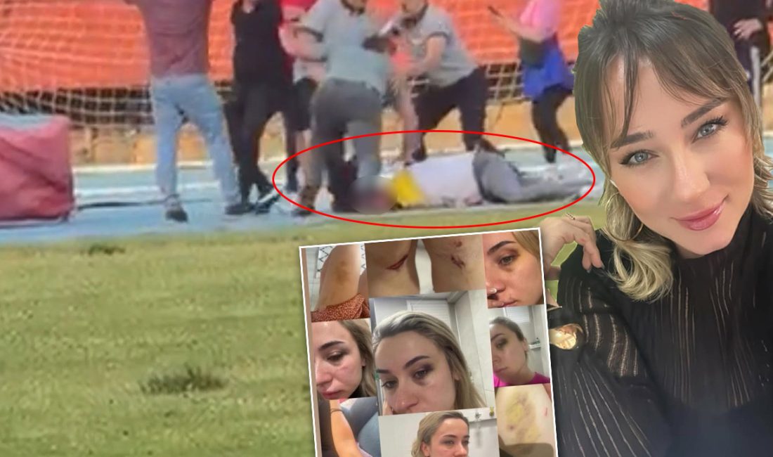 Zonguldak’ta eski eşinden gördüğü sistematik şiddete sosyal medya üzerinden “Artık