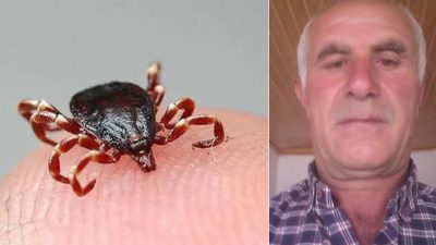 Tokat’ta vücuduna yapışan keneyi kendi imkanlarıyla çıkaran 61 yaşındaki Dursun
